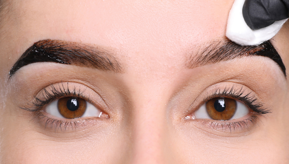 O Que Você Precisa Saber Antes de Escolher Esse Procedimento